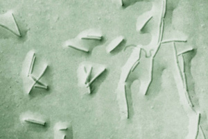 ナリネ菌電子顕鏡写真